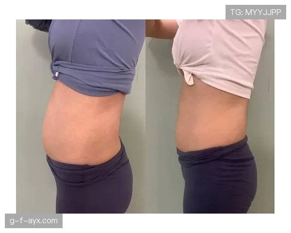 侯志慧这日常也太拼了，早上炉火纯青练瑜伽，晚上碳水狂欢炸肚皮！